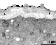 apertural area of pollen wall, intine (I), endexine (E)