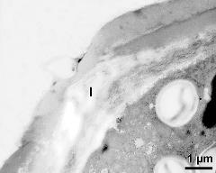 apertural area of pollen wall, intine (I)