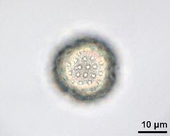 acetolyzed pollen, lower focus