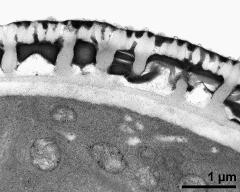 pollen wall, interapertural area