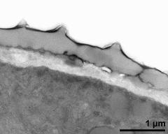 pollen wall, interapertural area