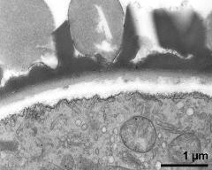 interapertural area of pollen wall