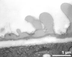 interapertural area of pollen wall