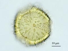 acetolyzed pollen,polar view