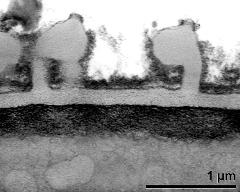 interapertural area of pollen wall