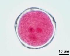 pollen grain with vegetative nucleus and two sperm cells