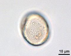 acetolyzed pollen,lower focus