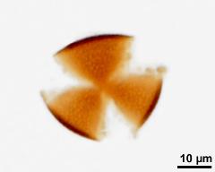 acetolyzed pollen, upper focus