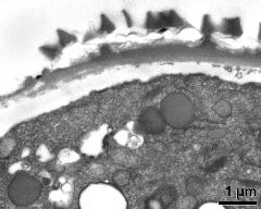 pollen wall at transition of aperture and interapertural area