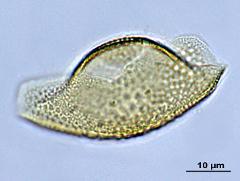 acetolyzed pollen,equatorial view