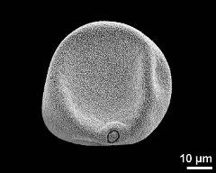 dry pollen grain in equatorial view