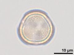 polar view,acetolyzed pollen